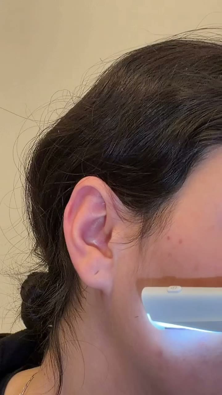 Jawline pass