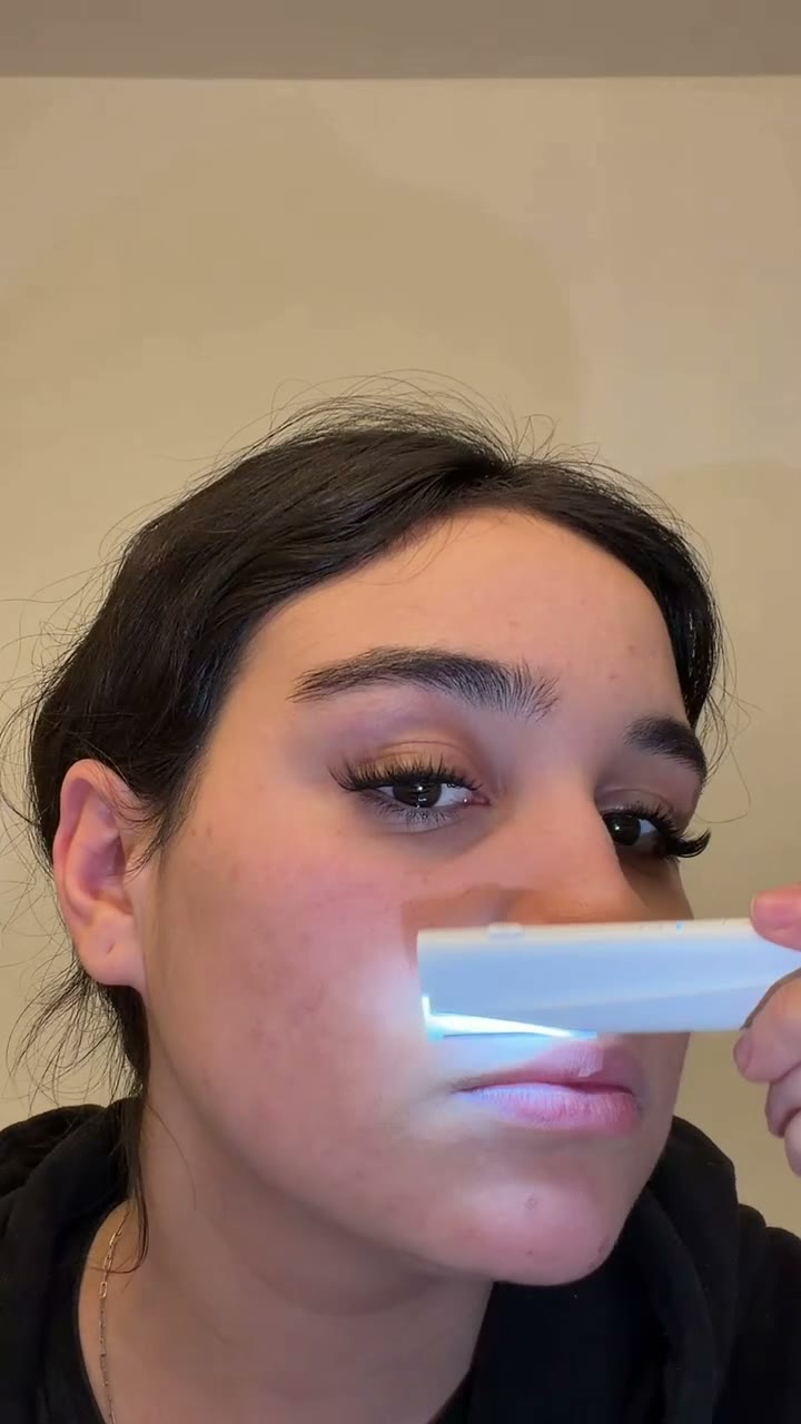 Upper lip pass